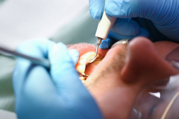 Best Emergency Dentist for Knocked-Out Tooth in South Amboy, NJ
